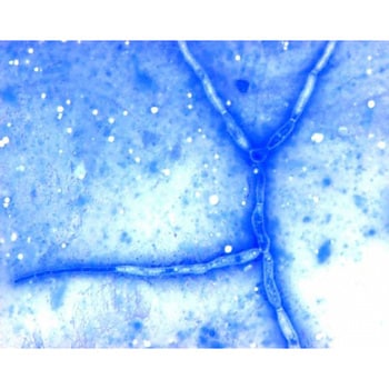 Chromolith(R) SemiPrep Si 100-10 mm 152015 1STMerck(默克密理博)1.52015.0001